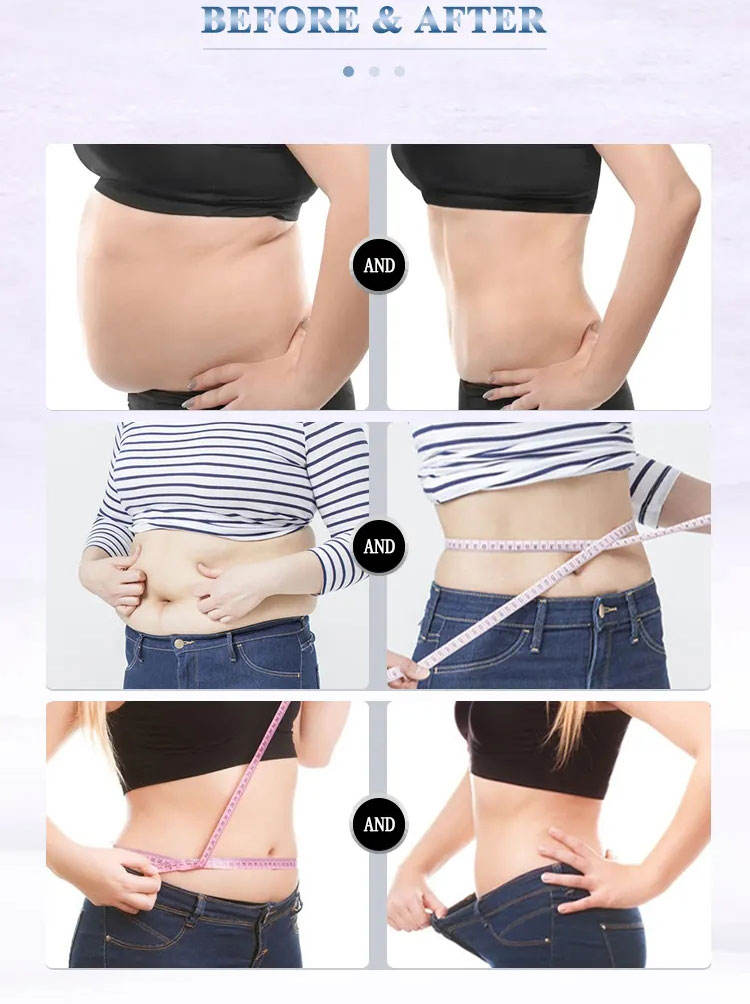 Hot Selling Fat Reduction Machine with Vacuum Roller for Body Shaping