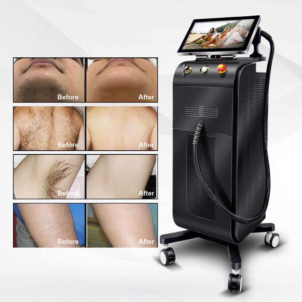 Factory Supply 755nm 808nm 1064nm Three Wavelength Diode Laser Hair Removal Device with TUV CE FDA