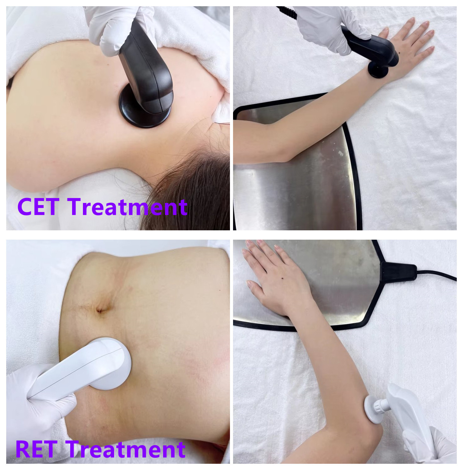 CET RET Radiofrequency Diathermy Machine Tecar Therapy for Physiotherapy Fascia Release Pain Management Physical Therapy