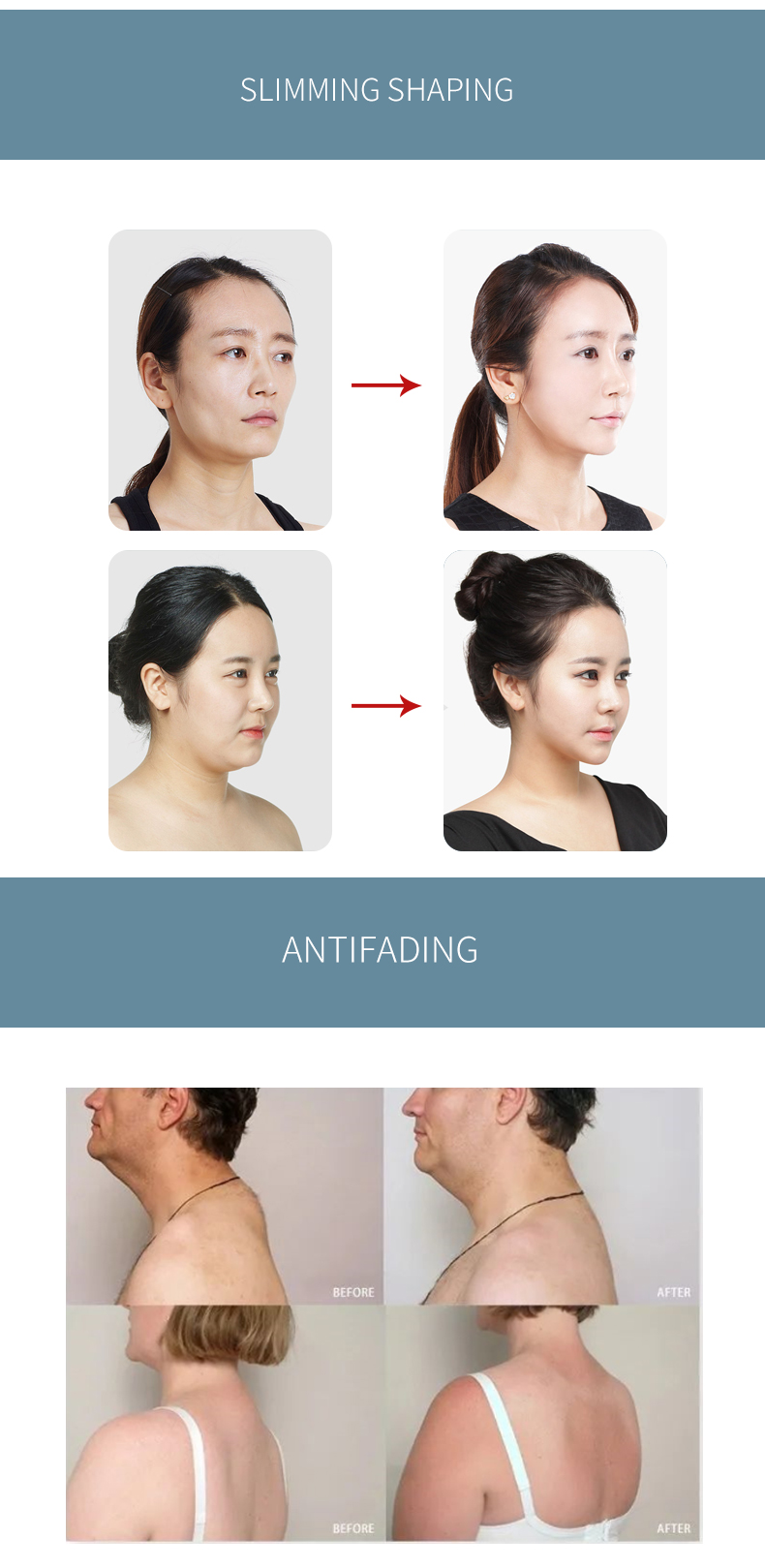 Before and After 2