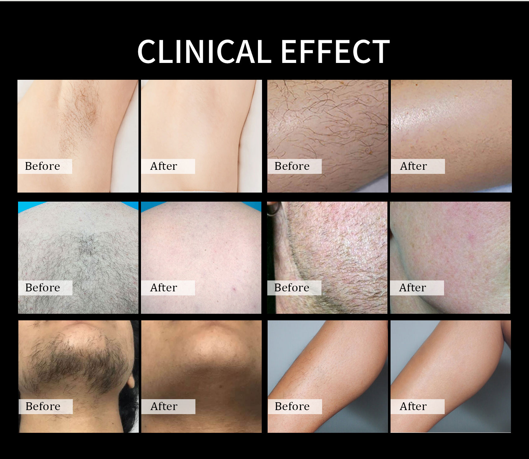 Skin types