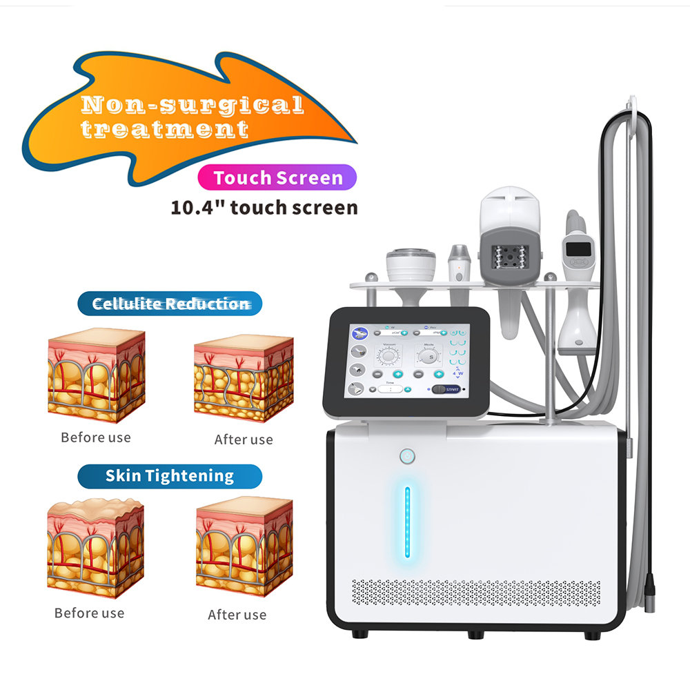 2026 Body Shaping Machine Vacuum Roller Mini Body Slimming Beauty Machine Skin Tightening Device