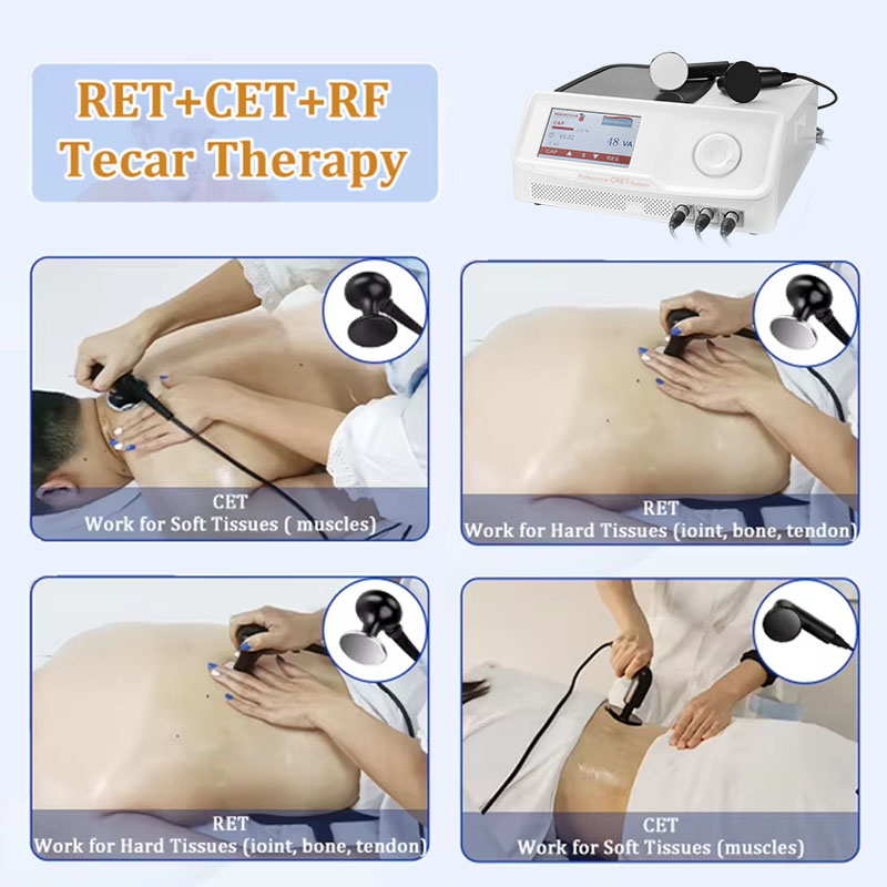 High Quality Tecartherapy 448khz Radiofrequency Tecar Machine Vet Body Care Therapy Equipment Smart Tecar Pro CET RET RF Machine