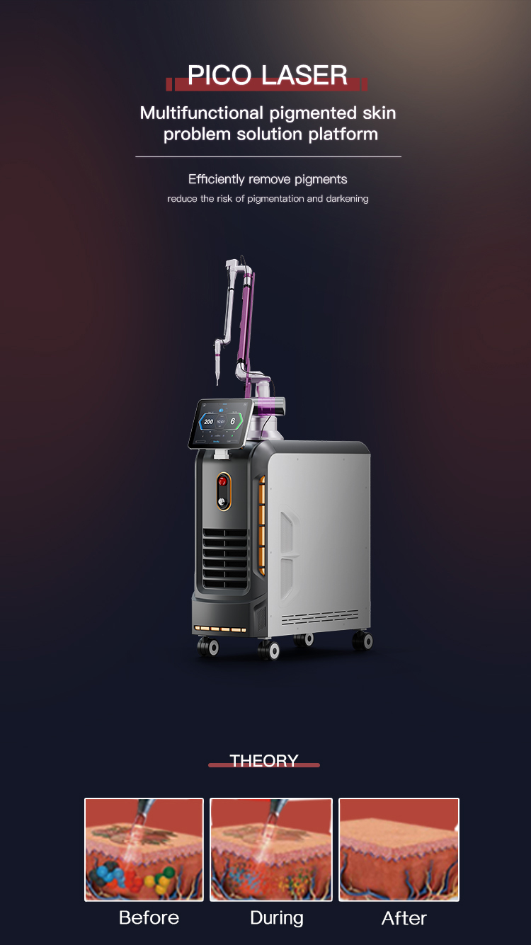 Laser Technology