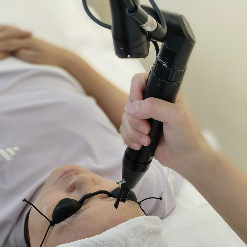 Portable Picosecond Laser Tattoo Removal Pigment Removal Q Switched ND YAG Laser Carbon Peel Machine