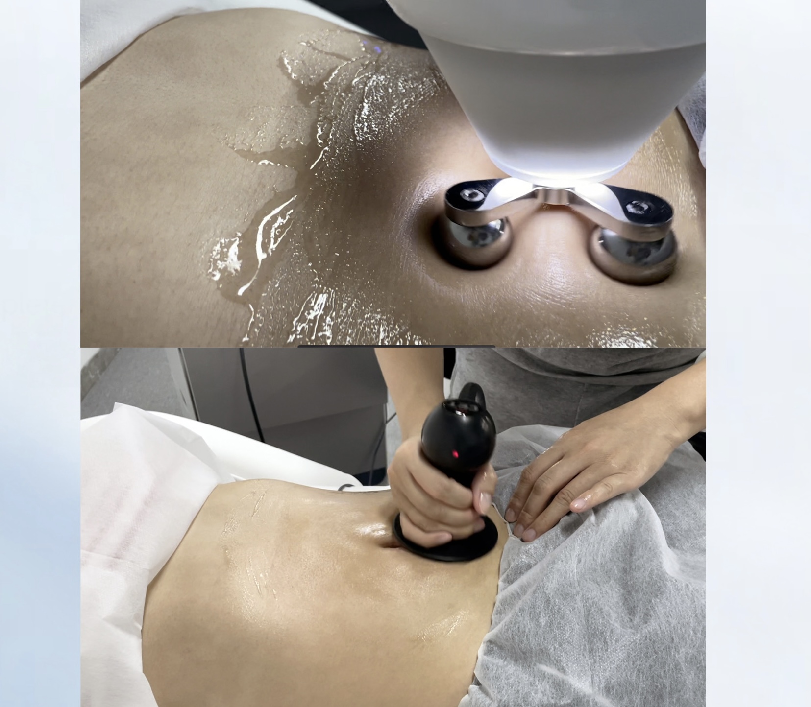 Portable Tecar Therapy 448khz 4 in 1 Ret Cet Tecar Vet Physical Therapy Pain Relief Weight Loss Tecar Physiotherapy Machine