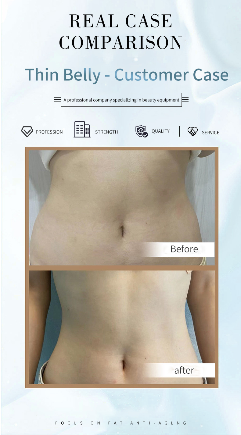Before and After 3