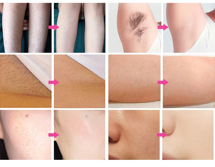 Before and After Treatment Comparison