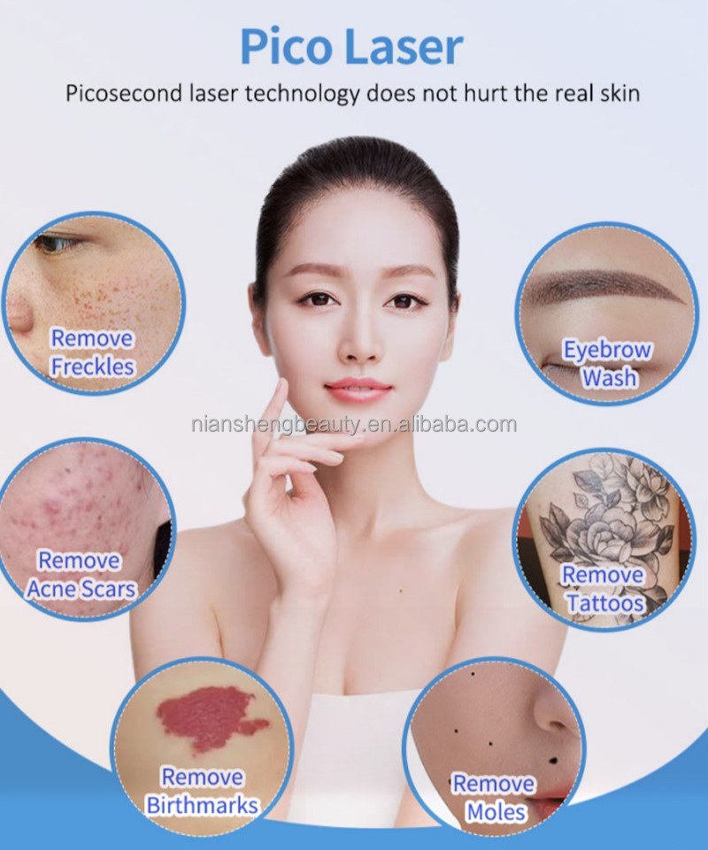 Picosecond Laser Tattoo Removal
