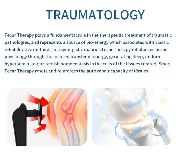 CET RET Radiofrequency Diathermy Machine Tecar Therapy for Physiotherapy Fascia Release Pain Management Physical Therapy