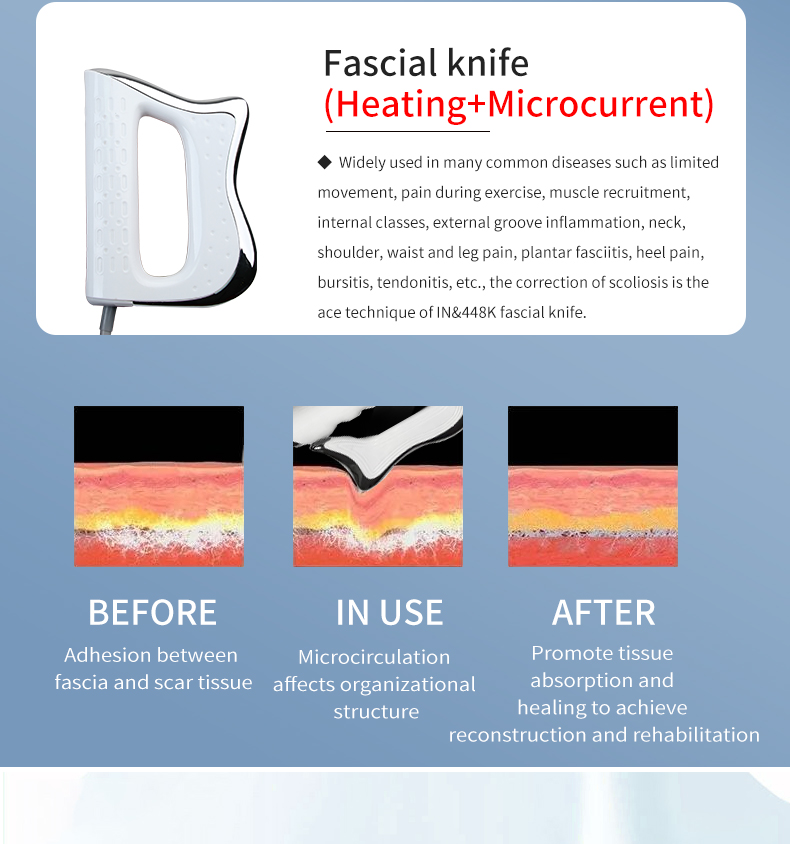 Handle Introduction 2