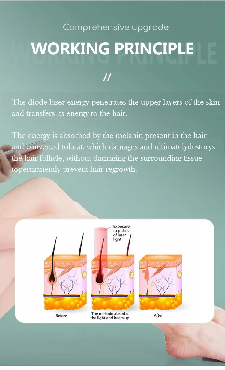 Laser Hair Removal Principle