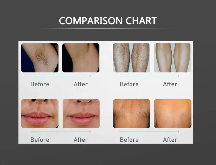 Comparison Chart Diagram