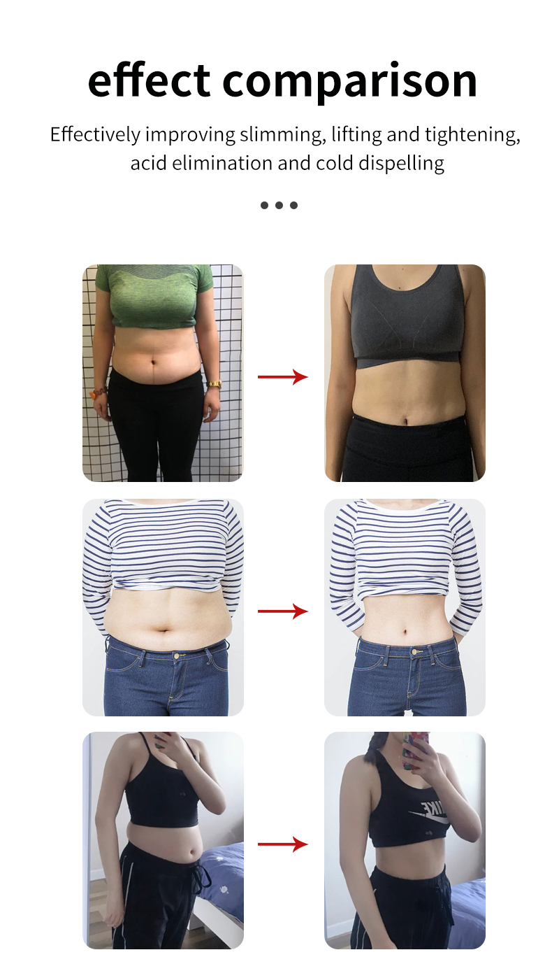Before and After 1