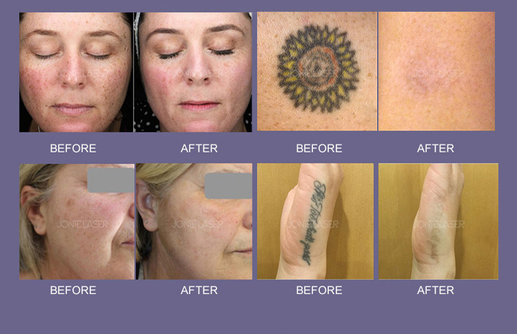 Treatment Result 6