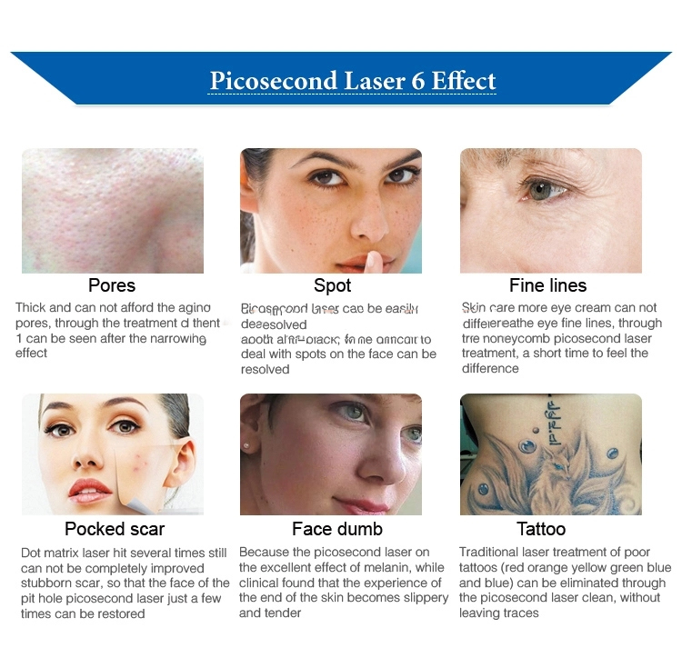 Picosecond Advantages