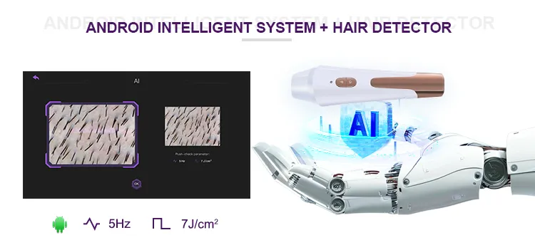 High Power 808 Diode Laser Ice Cooling Fast Hair Removal Device