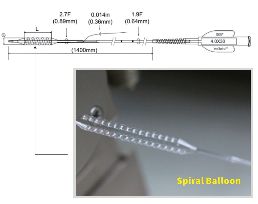 Catéter de globo espiral coronario semi compatible de intercambio rápido con globo espiral