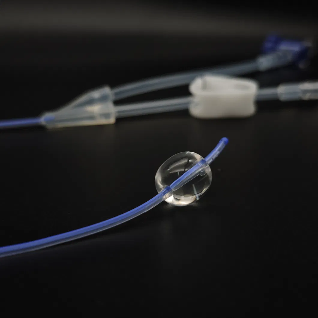 Suministros médicos catéter de histerosalpingografía con globo y alambre guía