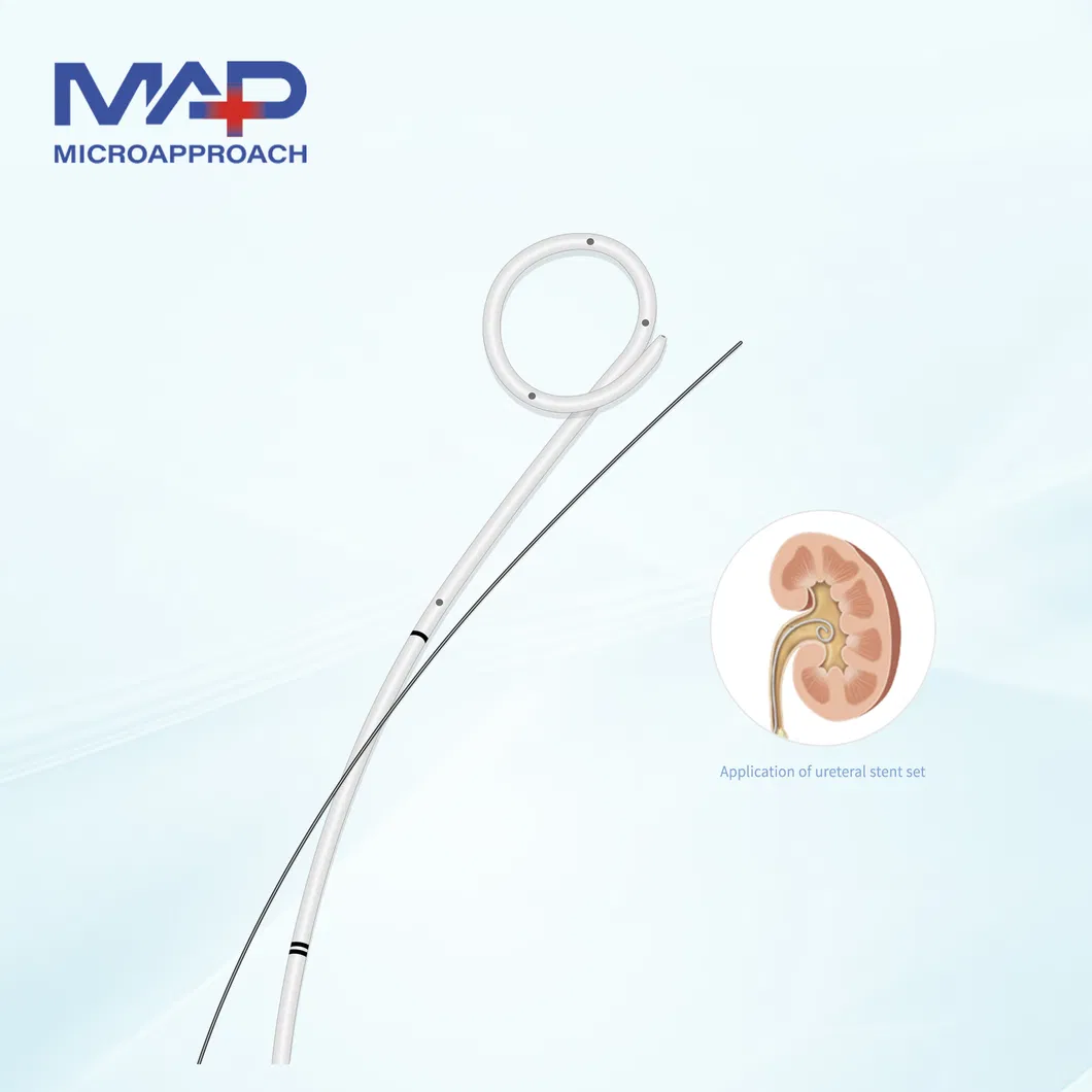 Kit de stent ureteral Jj