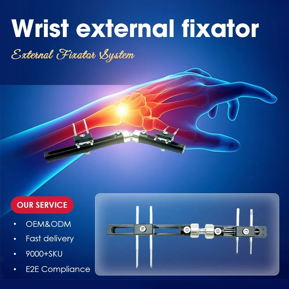 Wrist Lock PRO External Fixator 1