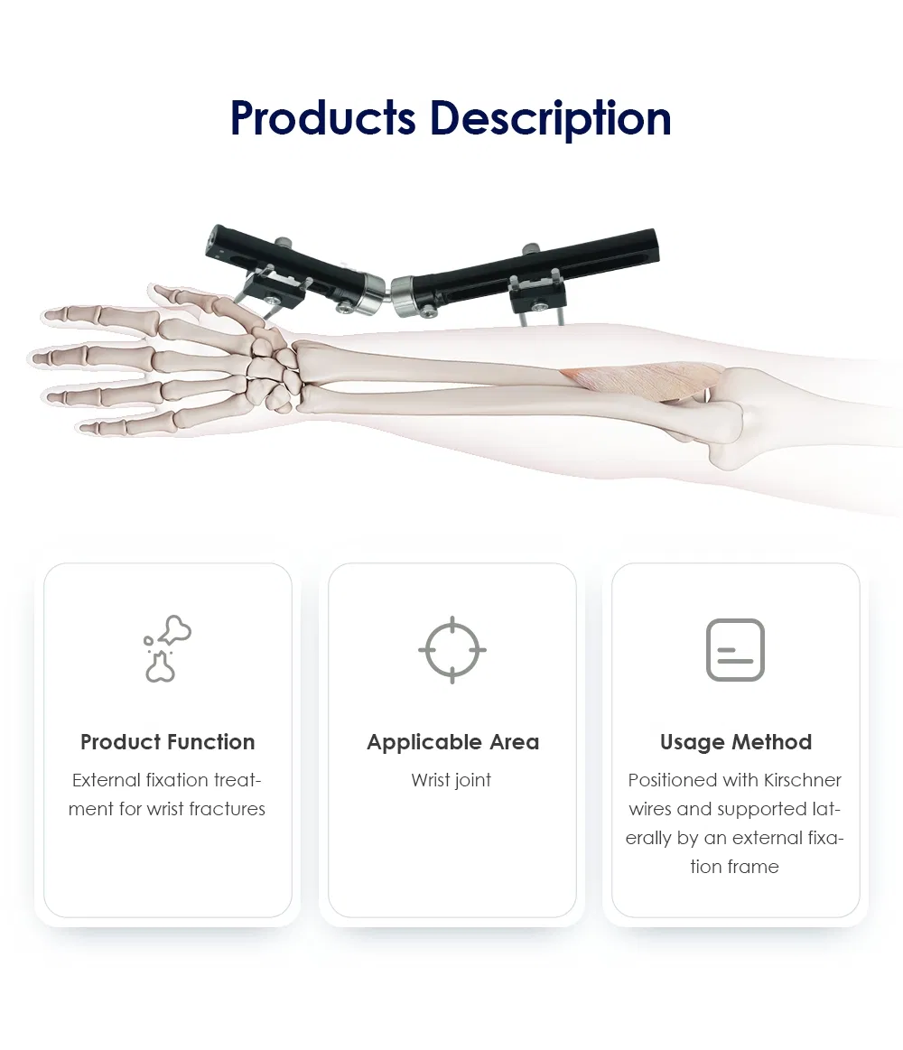 Wrist Lock PRO External Fixator 2