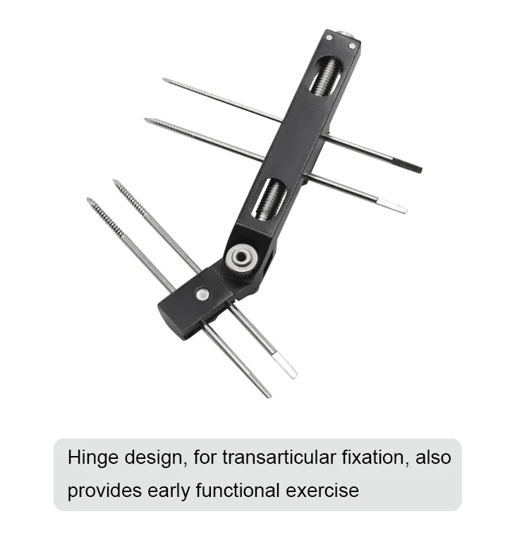 External Fixator Detail 3