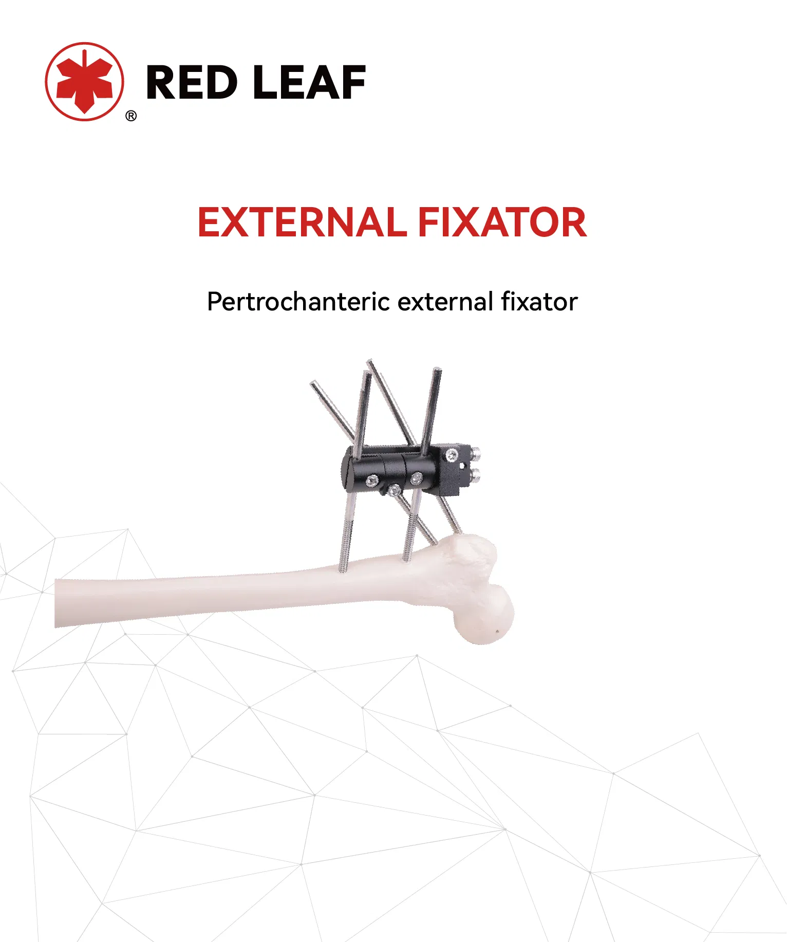 Pertrochanteric Orthopedic External Fixator