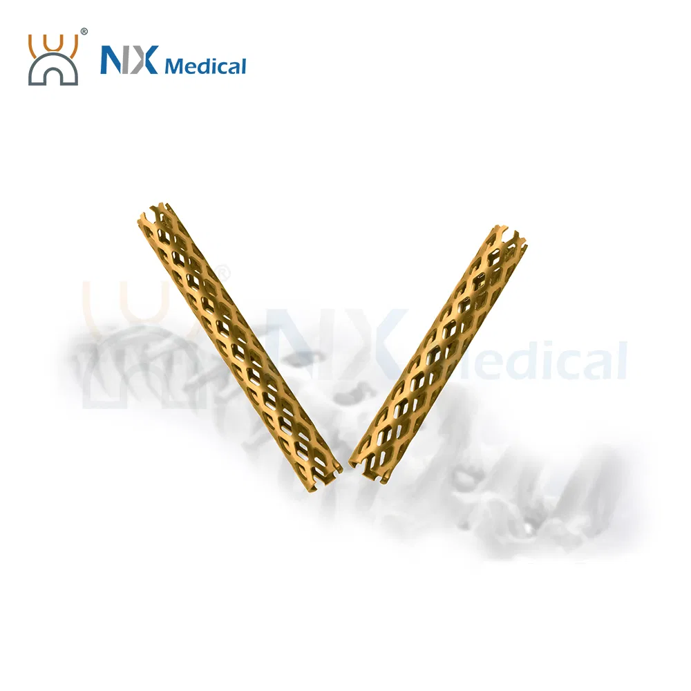 Nx Medical OEM Support Titanium Tlif Cage Peek for Posterior Lumbar Interbody Fusion