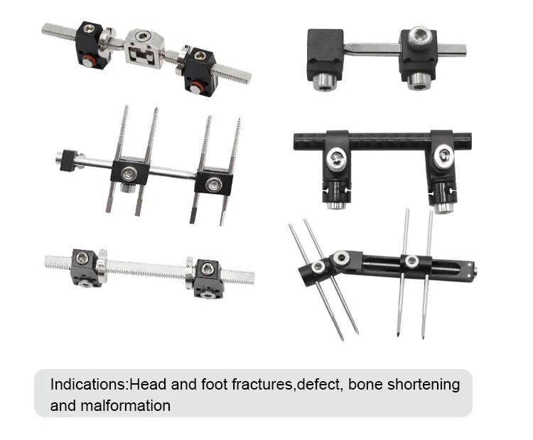 External Fixator Detail 1