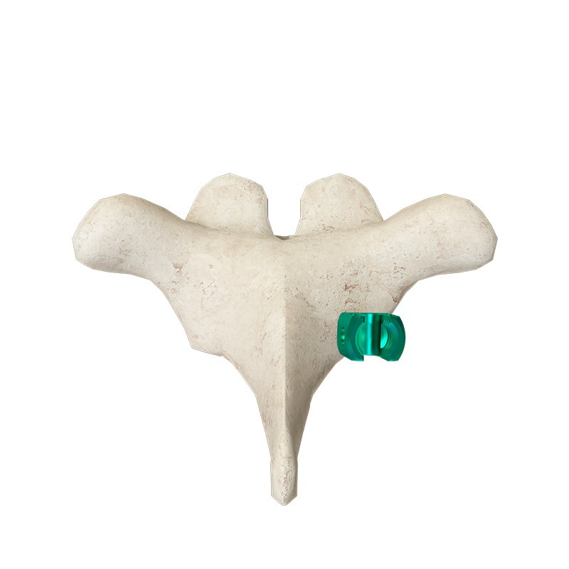 Premium Wide Blade Spinal Hook for Thoracolumbar Surgery