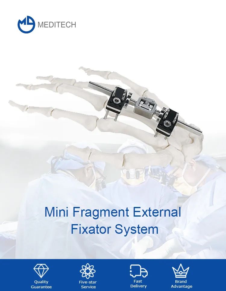 T-Type External Fixator