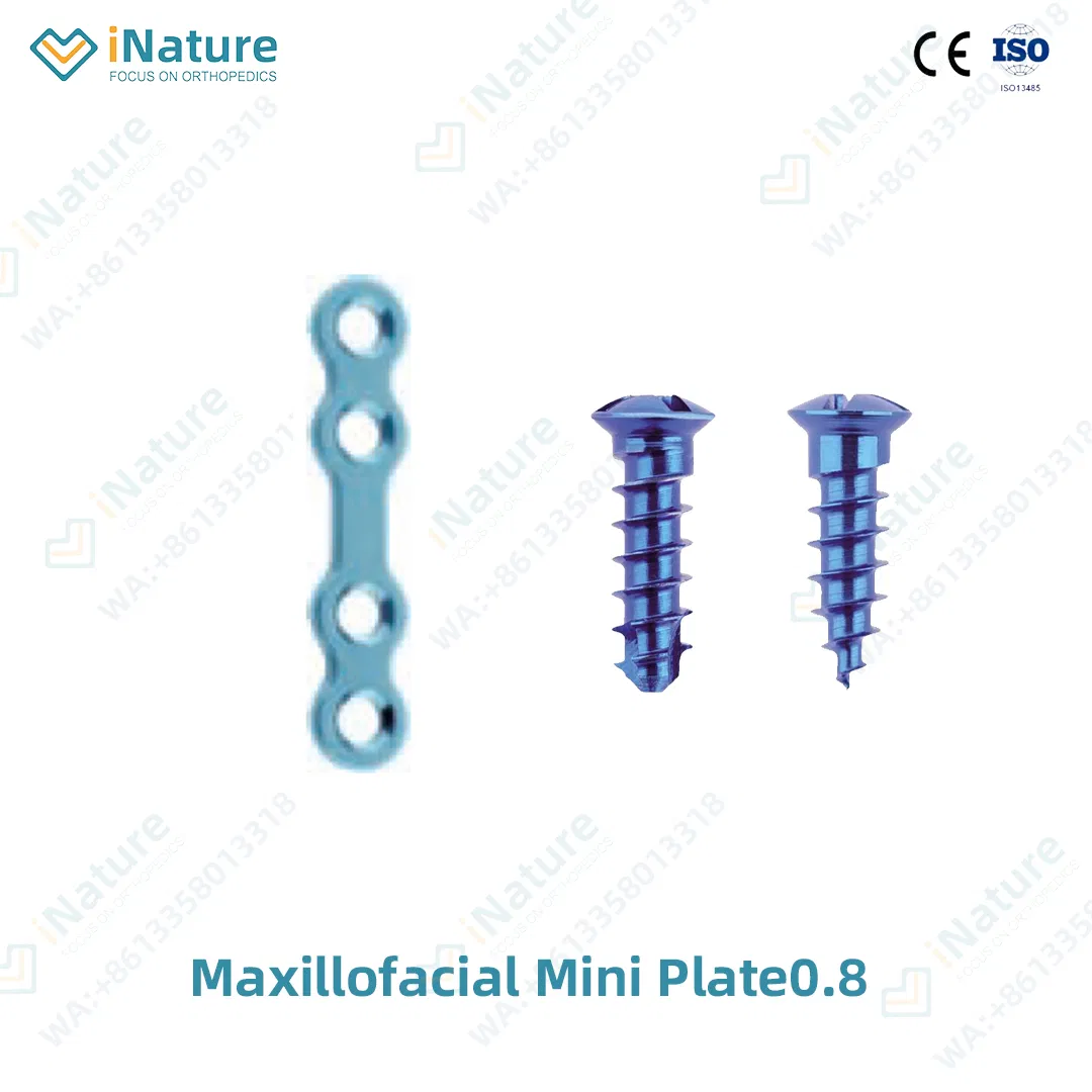 Titanium Alloy Maxillofacial Locking Plate for Jaw Fracture Fixation