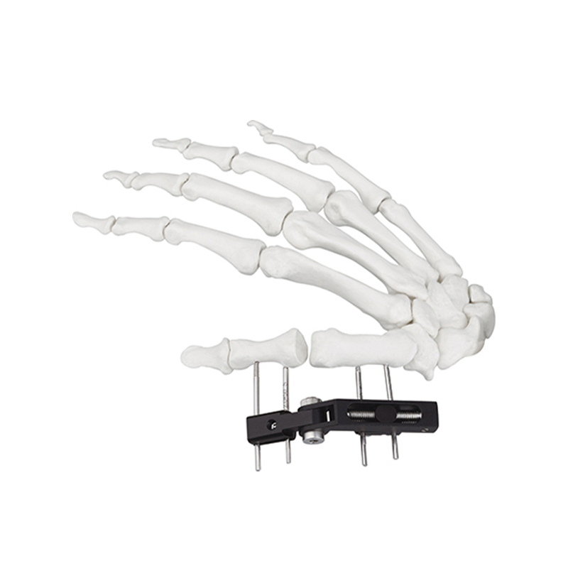 Cn Manufacturer Finger External Fixator for Mini Fixator Straight Type