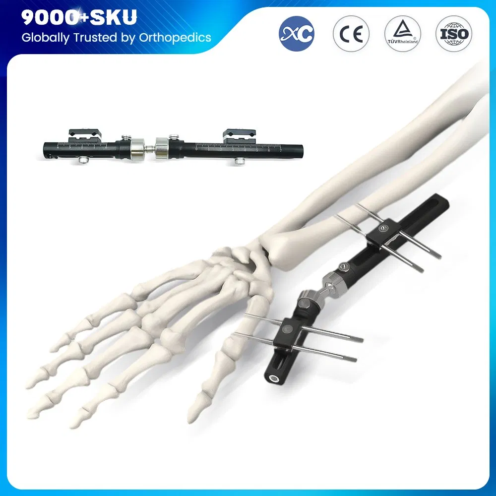 Wrist Lock PRO External Fixator System for Distal Radius Fracture Stabilization