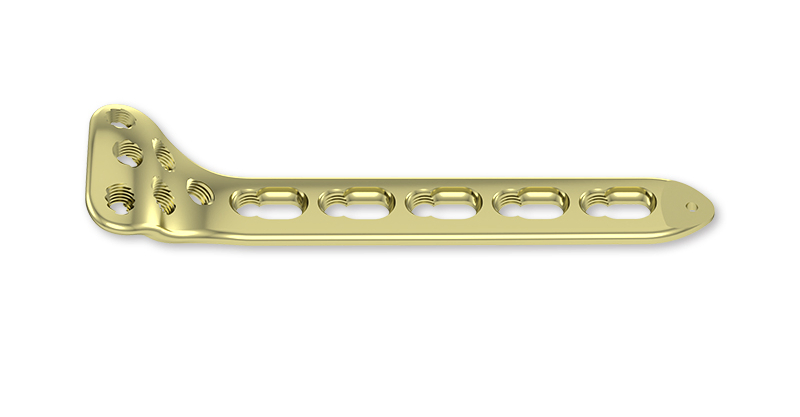Orthopedic Locking Plate for Distal Radius