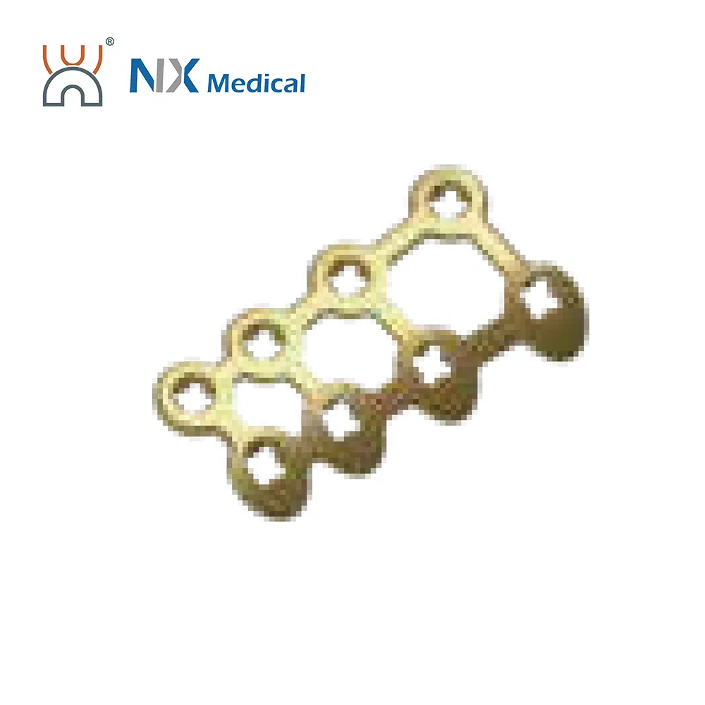Nx Medical Variable Angle Super Orthopedic Locking Plate Bone Fixation Plate