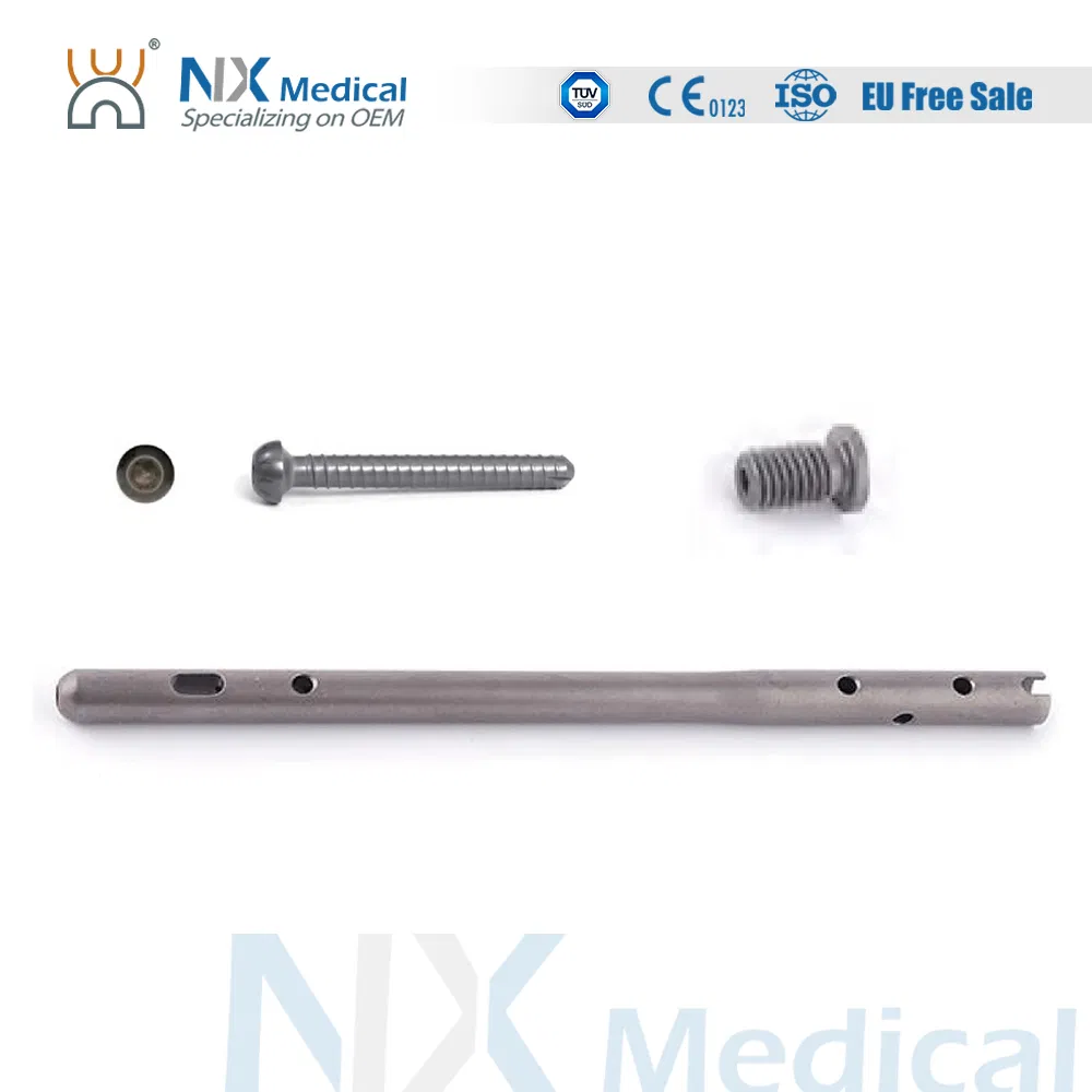 Nx Medical Titanium Orthopedic Orthopaedic Foot Ankle Fusion Intramedullary Nail