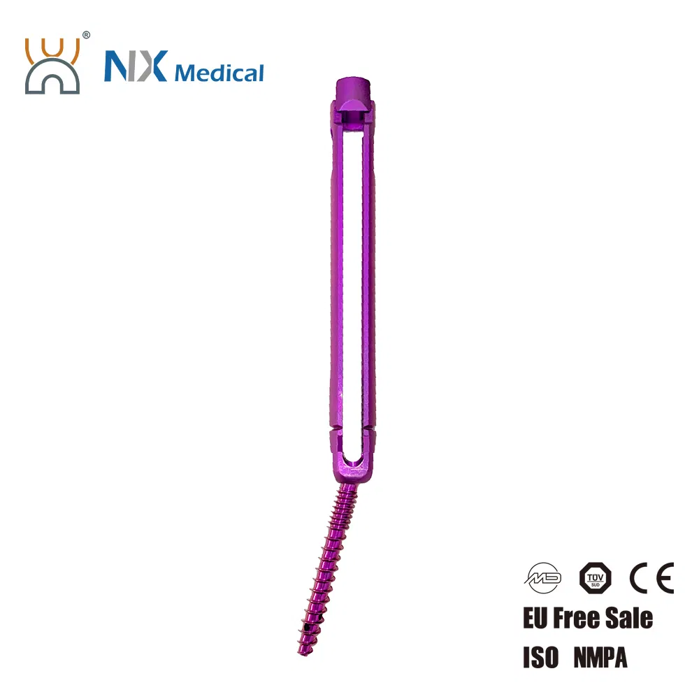 Nx Medical Orthopedic Implant Mis Cannulated Bone Cement Spinal Pedicle Screw