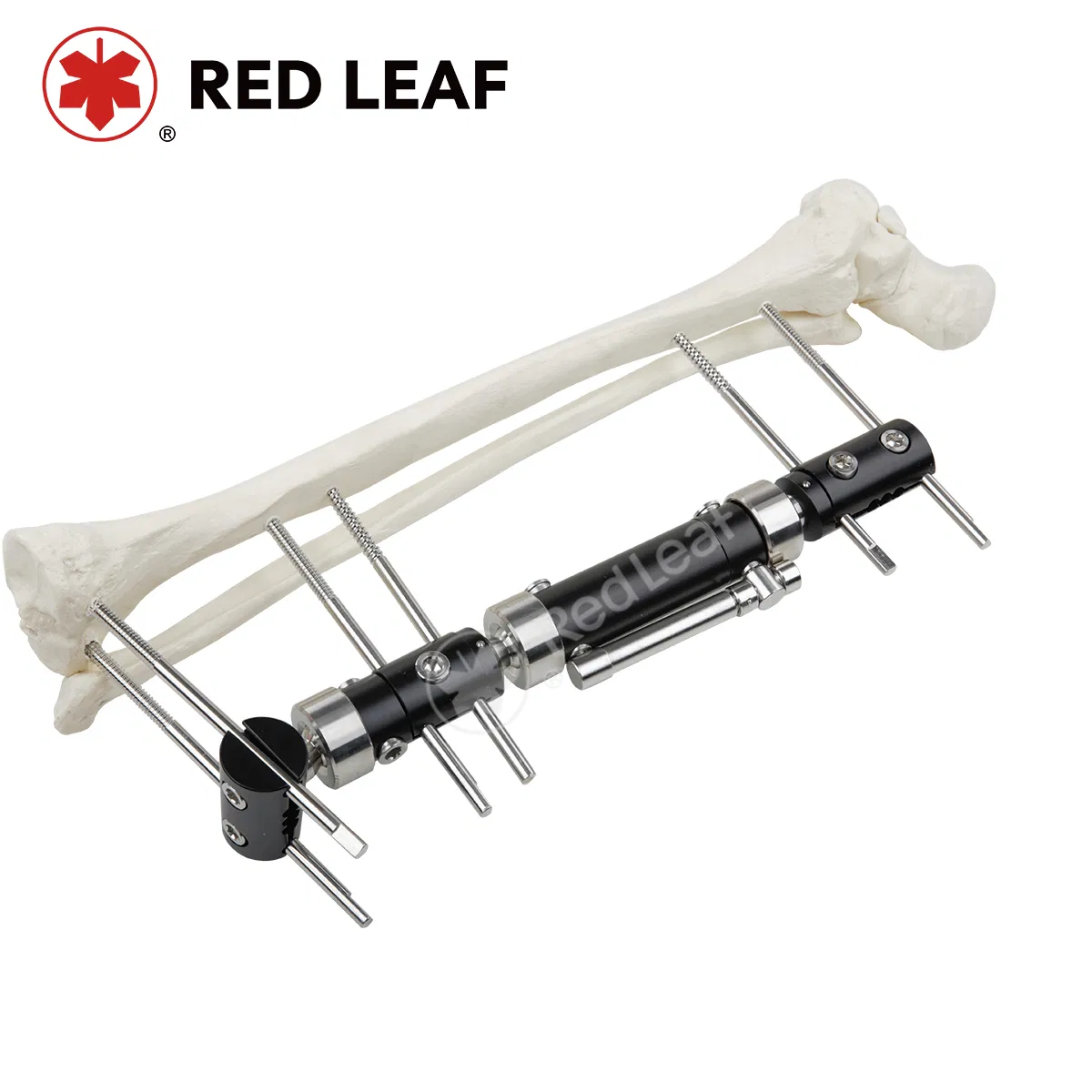 Orthopedic Surgery Fracture External Fixator Three-Section Type Medical Fixation