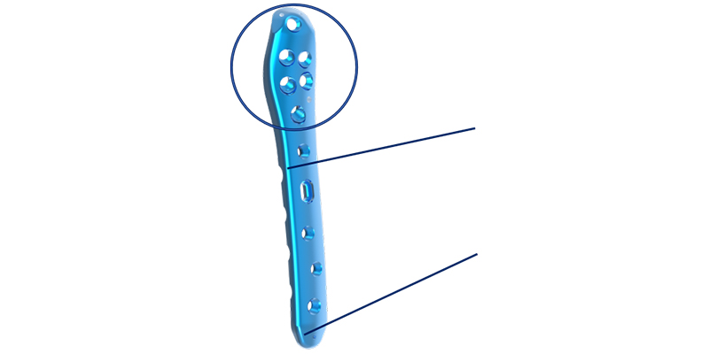 Fixation points and shaft contouring