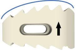 Contraindication Considerations
