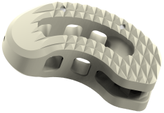 Thoracolumbar Interbody Cage Angled