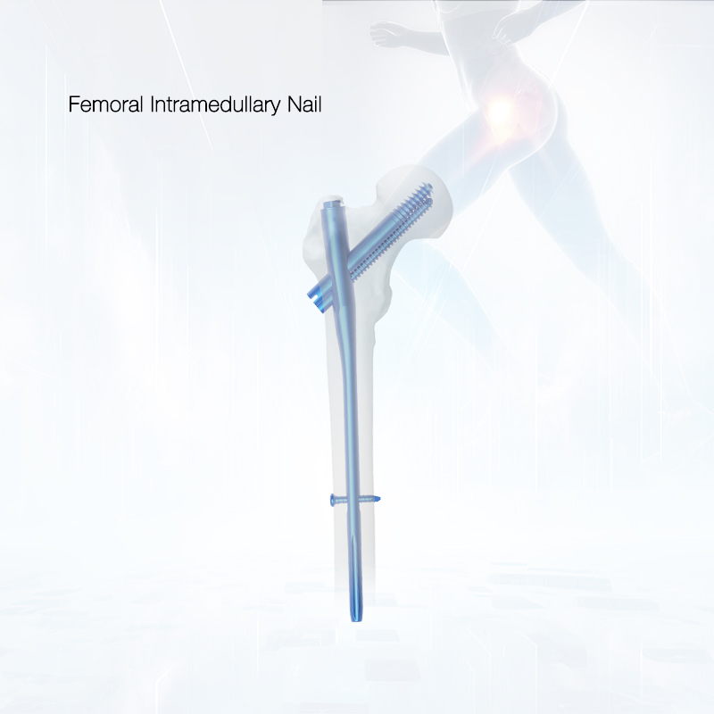 OEM Surgical Hospital Use InterZan Titanium Interlocking Nail for Femur Supplier, Factories