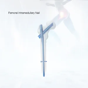 OEM Surgical Hospital Use InterZan Titanium Interlocking Nail for Femur Supplier, Factories