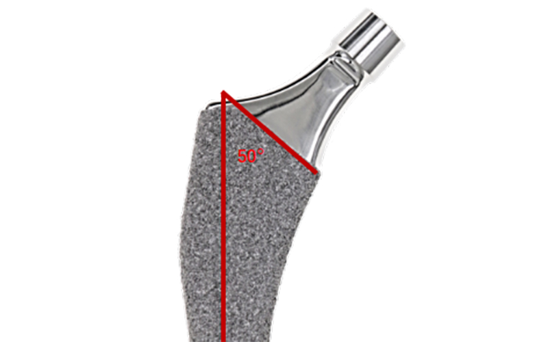 Groove Design Lateral View
