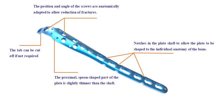 Proximal Ulna Locking Compression Plate Structural View