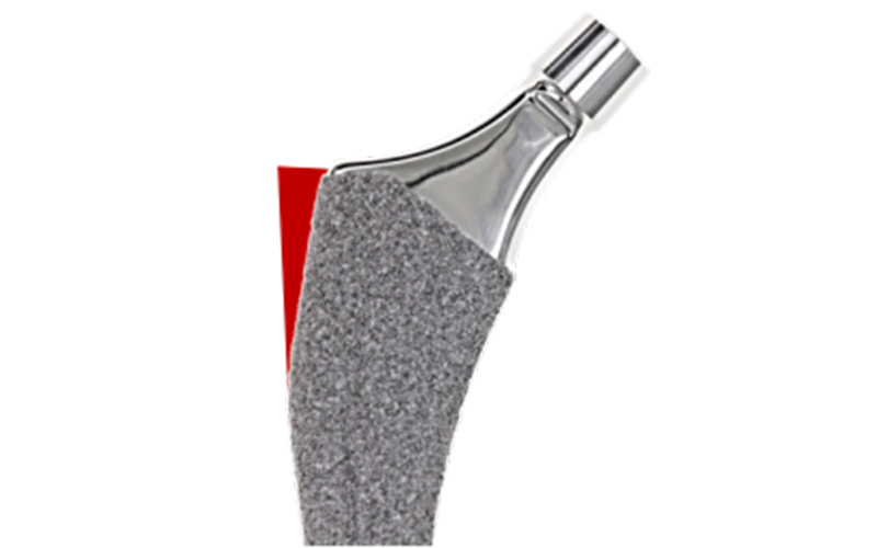 Neck Profile