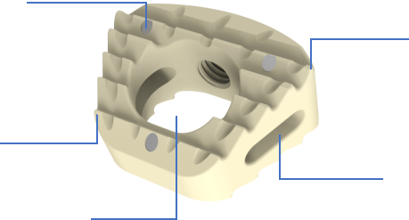 Cervical Implant Verification