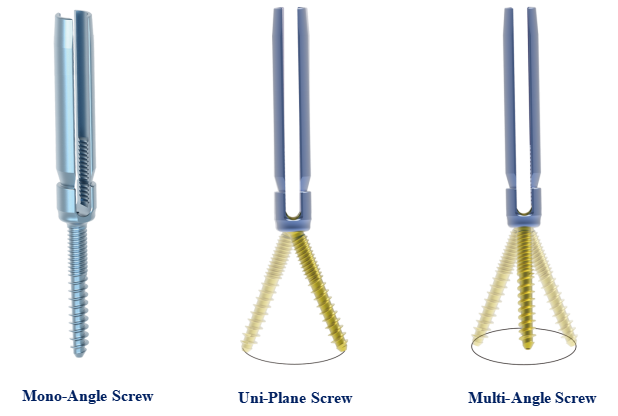 Screw Locking System